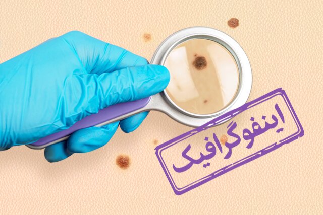 اینفوگرافیک/ غربالگری سرطان‌های شایع در کشور