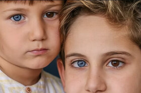 چرا چشم‌های برخی از افراد دو رنگ است؟