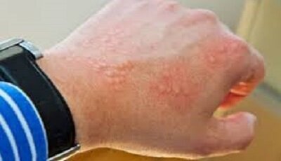 بروز مشکلات گوارشی و آلرژی‌های پوستی نتیجه استفاده از کالاهای بدون برچسب اصالت