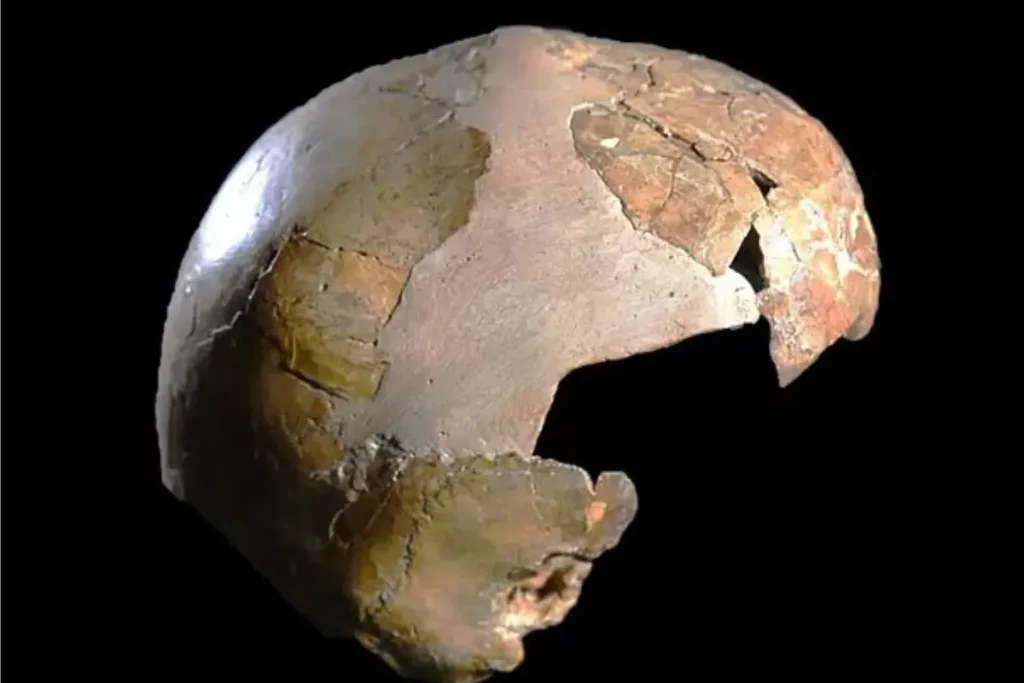 اگر دچار سردرد میشوید شاید اجداد ۲۵۰ هزار سال پیشتان مقصر باشند!