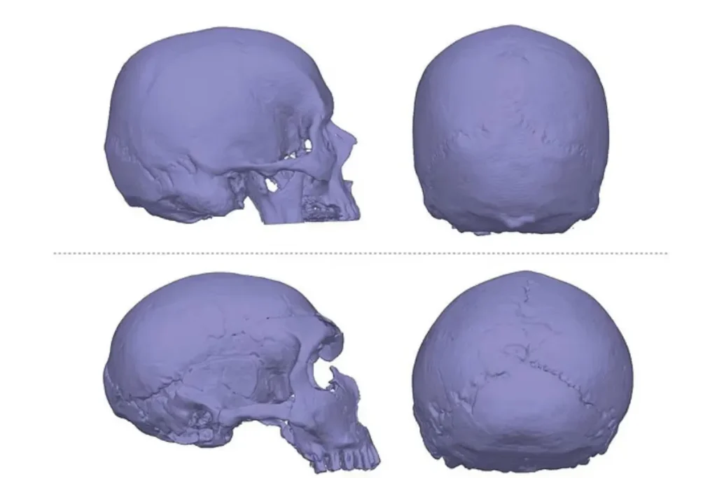 اگر دچار سردرد میشوید شاید اجداد ۲۵۰ هزار سال پیشتان مقصر باشند!