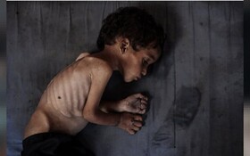 فاجعه انسانی در غزه؛ مرگ کودکان بر اثر گرسنگی و سکوت جهانی