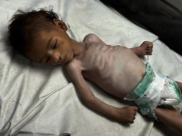 غزه در آستانه فاجعه انسانی؛ هشدار سازمان ملل نسبت به مرگومیر کودکان ناشی از گرسنگی
