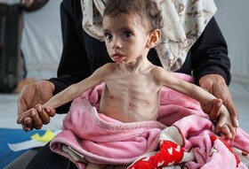 سازمان ملل: سوء تغذیه حاد در میان کودکان غزه به بالاترین سطح خود رسیده است