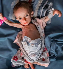 خطر قریب‌الوقوع مرگ بیش از ۱۰۰ هزار نوزاد در غزه به دلیل کمبود شیرخشک