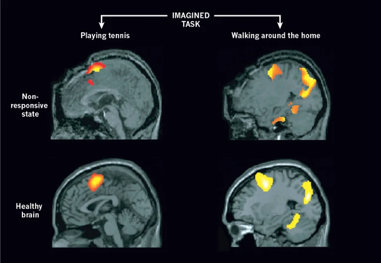 از مغز انسان تا هوش مصنوعی؛ تلاش دانشمندان برای ردیابی آگاهی