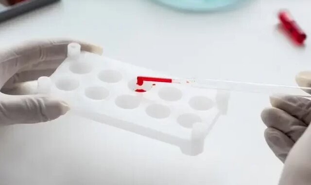 از «O» بمبئی تا دی‌دش‌دش