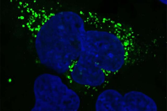 هوش مصنوعی، نیمه تاریک ژنوم انسان را شناسایی میکند