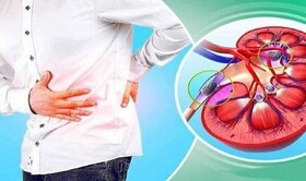 ضرورت مراقبت از کلیه‌ها در تابستان هنگام فعالیت پیاده‌روی