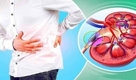 ضرورت مراقبت از کلیه‌ها در تابستان هنگام فعالیت پیاده‌روی
