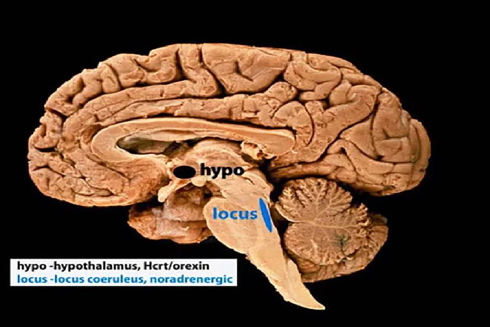 دکمه بازنشانی مغز کشف شد