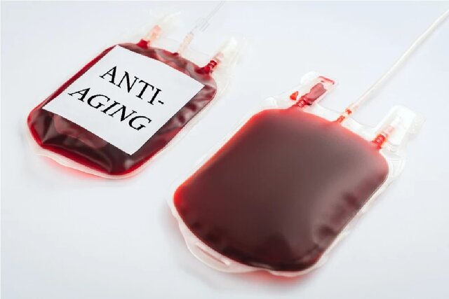 جوانسازی پوست با ترکیب خون تازه و مغز استخوان جوانسازی پوست با ترکیب خون تازه و مغز استخوان