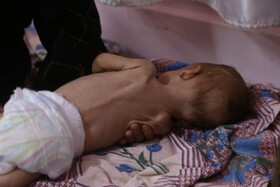 عفو بین‌الملل: اسرائیل عمدا در راستای نسل کشی، به فلسطینی‌ها گرسنگی داده است