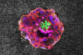 ثبت تصاویر ۳ بُعدی از لانه‌گزینی جنین انسان برای اولین بار