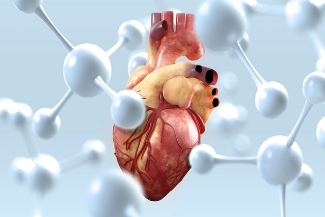 سن سکته قلبی در ایران ۱۰ سال زودتر از اروپا سن سکته قلبی در ایران ۱۰ سال زودتر از اروپا