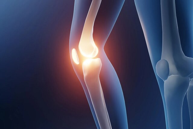 به تاخیر انداختن جراحی زانو با یک تغییر کوچک در راه رفتن