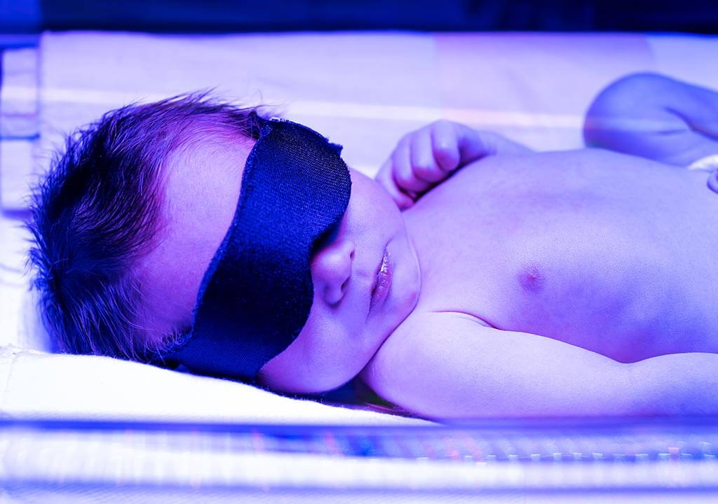 زردی نوزاد تا چند روزگی خطرناک است/ راه درمان چیست