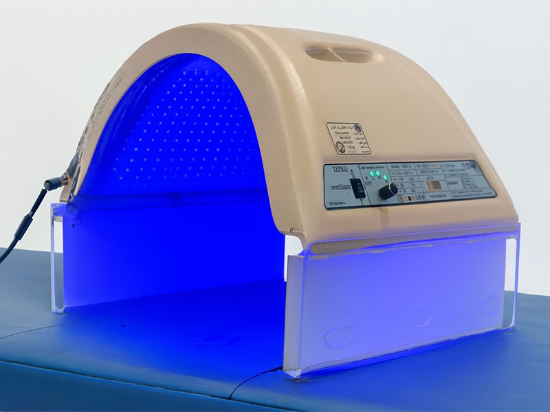 زردی نوزاد تا چند روزگی خطرناک است/ راه درمان چیست