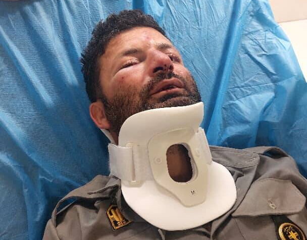 دومین حمله به حافظان طبیعت در شمیرانات؛‌ این بار ضرب و شتم یک محیط‌ بان