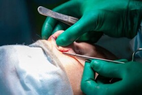 چرا شیادها در بازار جراحی زیبایی کاسبی شان پررونق است؟