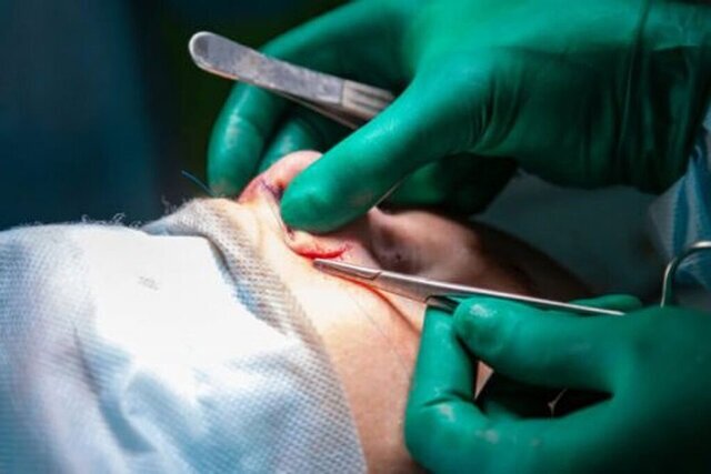 چرا شیادها در بازار جراحی زیبایی کاسبی شان پررونق است؟