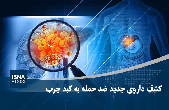 ویدیو/ کشف داروی جدید ضد حمله به کبد چرب