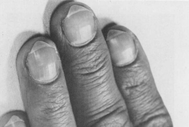 برندگان «نوبل مضحک» ۲۰۲۵ اعلام شدند