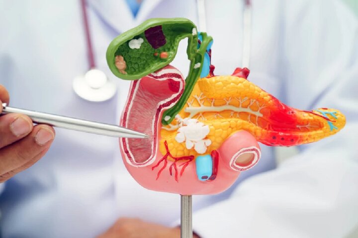 نقطه ضعف سرطان لوزالمعده کشف شد! نقطه ضعف سرطان لوزالمعده کشف شد!