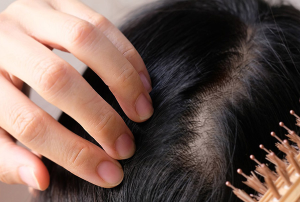 موهای سالم، راز اعتماد به نفس! ریزش موی خود را متوقف کنید