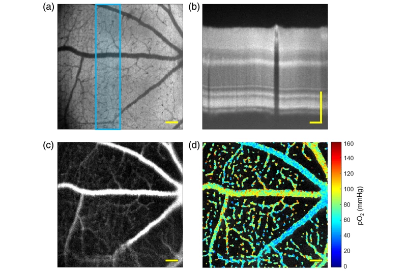 این فناوری تصویربرداری جدید، دزد بینایی را دستگیر میکند