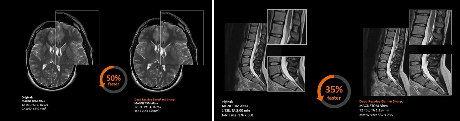 ارائه خدمات MRI تخصصی 1.5 تسلا در مرکز دکتر قادسی بابلسر