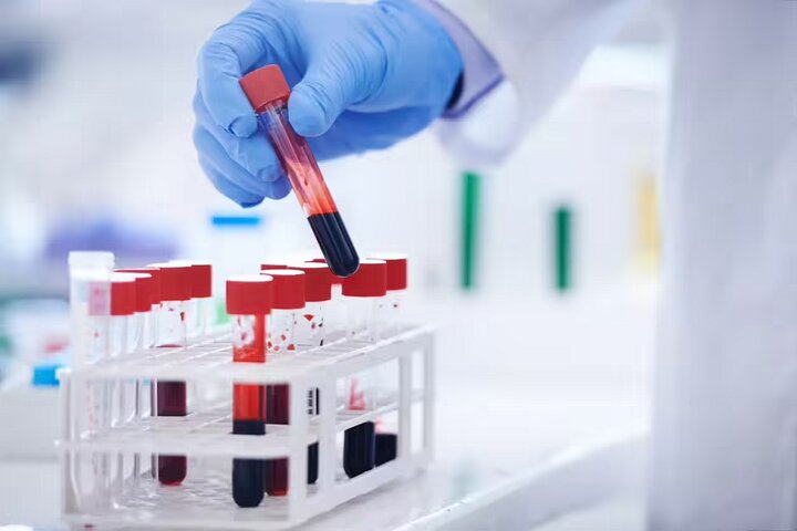 تشخیص خستگی مزمن با یک آزمایش خون پیشرفته