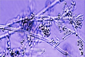 بانداژهای ساخته شده از قارچهای زنده؛ آینده التیام زخم