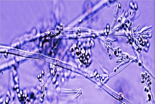 بانداژهای ساخته شده از قارچهای زنده؛ آینده التیام زخم بانداژهای ساخته شده از قارچهای زنده؛ آینده التیام زخم