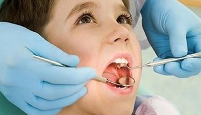 عکس تزیینی است. نخستین دندان دائمی؛ چرا «دندان شش» آینده لبخند کودکان را میسازد؟