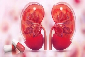 تولید اولین مولکول داروی کاهش رد پیوند کلیه/صرفهجویی ۳.۵ میلیون دلاری با بومیسازی دارو