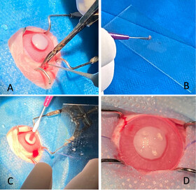 افقی تازه در درمان زخمهای شدید قرنیه/ ترمیم زخم قرنیه با روش جدید در دانشگاه تهران