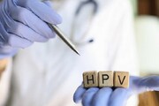 معاون دانشگاه علوم پزشکی شیراز: مدیریت HPV نیازمند اقدامات پیشگیرانه و مداخلات علمی است