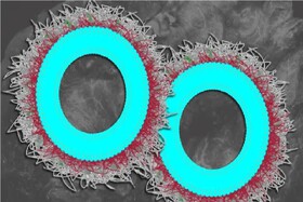 نابودی بیش از ۸۰ درصدی تومورهای تخمدان با نانوذرات جدید