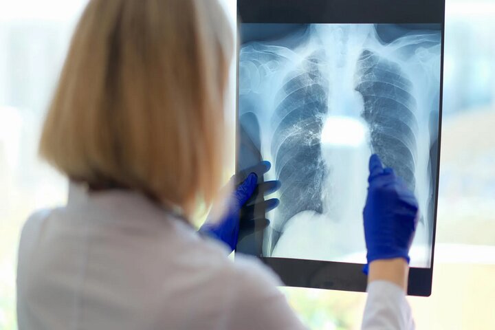 یک مشکل پنهان تنفسی ممکن است دلیل خستگی مزمن باشد