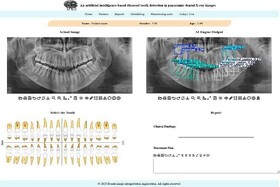 توسعه سامانه هوشمند تحلیل تصاویر دندانپزشکی در دانشگاه تهران