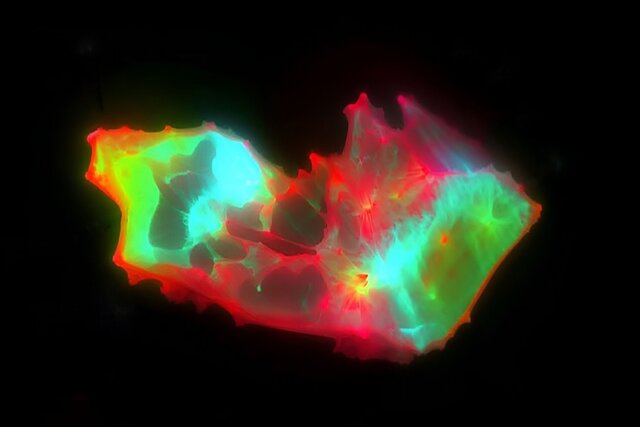 کشف ساختارهای عجیب و غریب در خون افراد مبتلا به کووید طولانی‌مدت