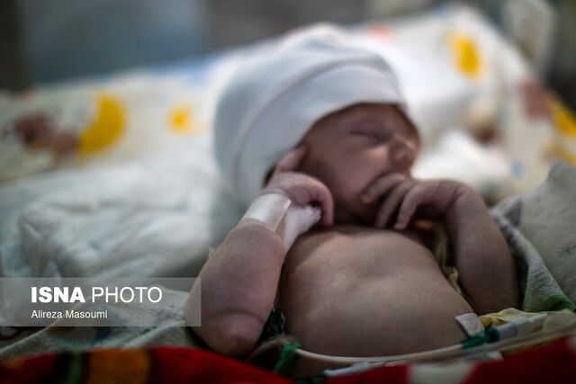 ناهنجاری‌های بدو تولد اولین عامل مرگ کودکان زیر ۵ سال