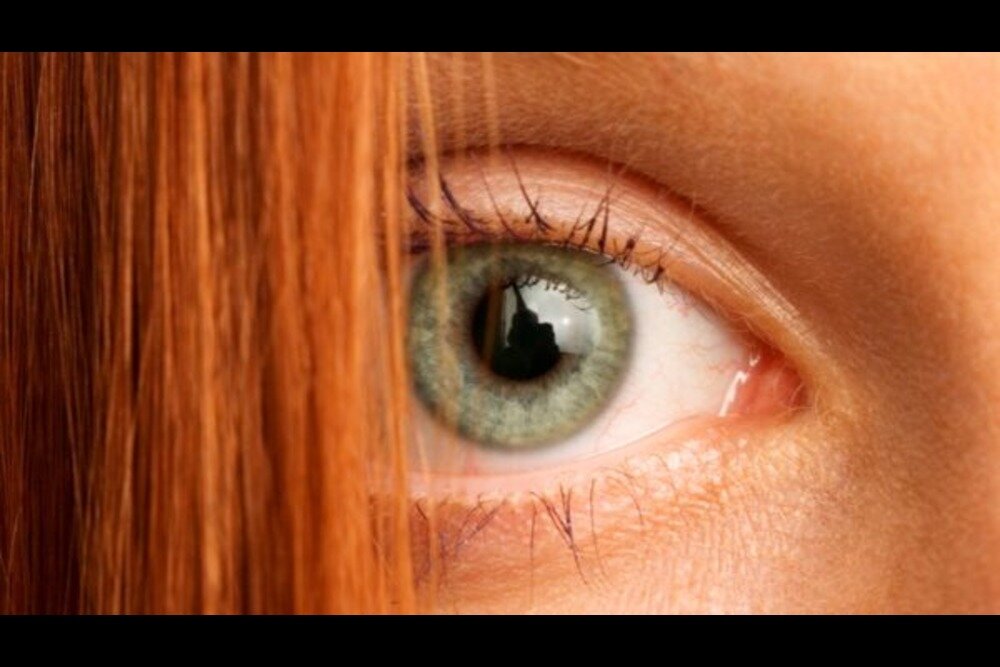 دلیل بهبود نیافتن برخی زخم‌ها در ژن موی قرمز نهفته است