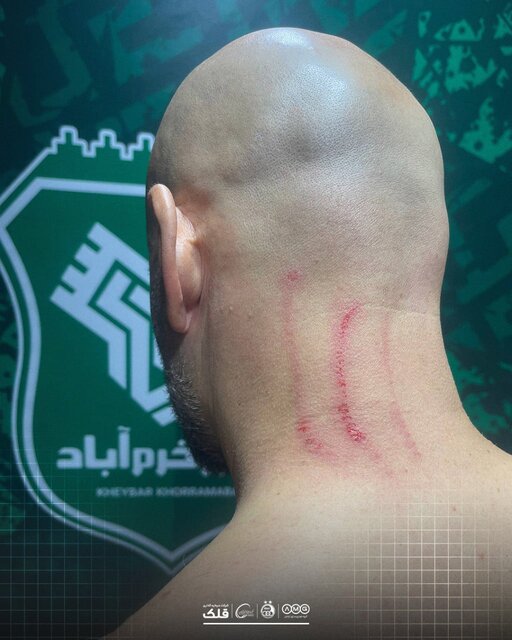 واکنش باشگاههای استقلال و خیبر به اتفاقات بازی امروز