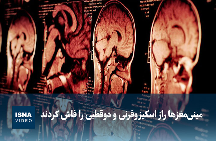 ویدیو/ مینی‌مغزها راز اسکیزوفرنی و دوقطبی را فاش کردند