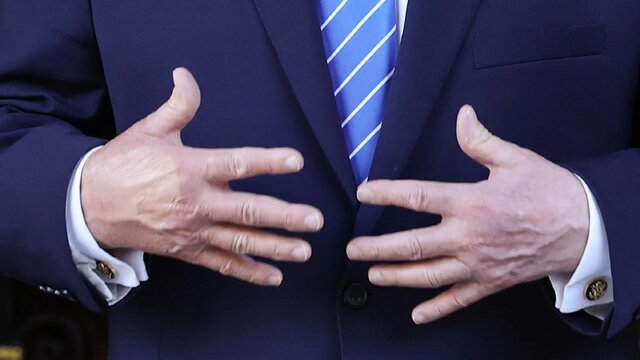 تلاش دیگر ترامپ برای پنهان کردن کبودی روی دستش