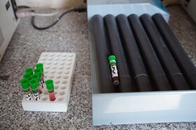 مراحل حفظ نمونه ها در آزمایشگاه