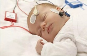 غربالگری شنوایی بیش از ۲۵ هزار کودک خراسان جنوبی/ شناسایی ۱۴۵ کودک دارای افت شنوایی