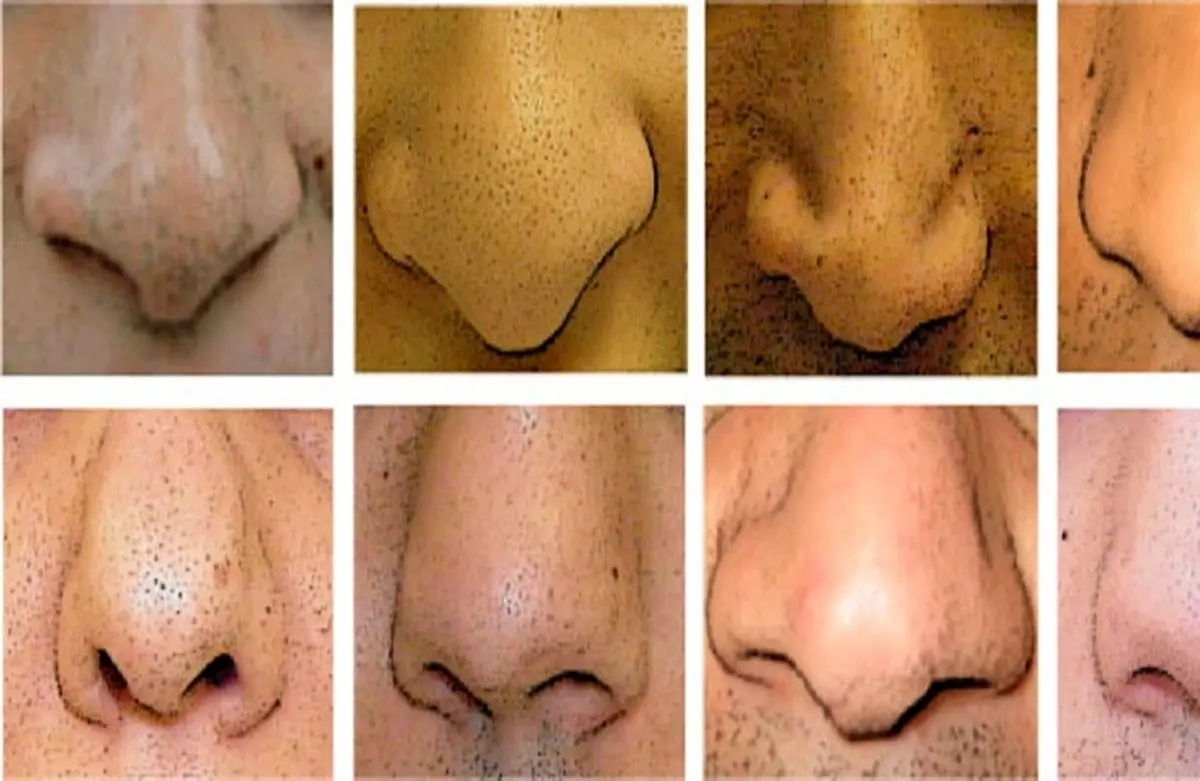 هیچ بینی‌ ایده‌آلی در جهان وجود ندارد